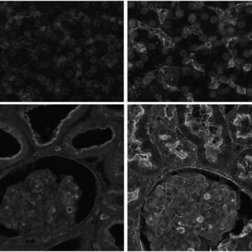 Ricercatori di Yale riattivano le funzioni cellulari di un mammifero ore dopo la sua morte